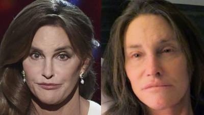 El antes y después de Caitlyn Jenner.