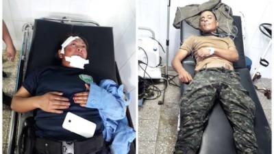 Dos de los cuatro agentes del orden heridos durante los desalojos en varios puntos del país por miembros de la Alianza de Oposición.