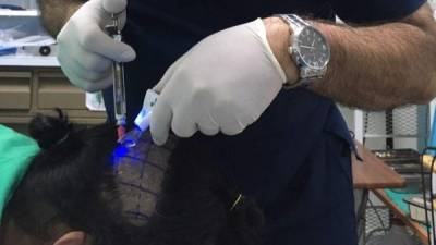 El dermatólogo Cándido Mejía practicando este tipo de cirugías.