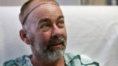 James Boysen es la primera persona en el mundo en recibir un trasplante de cráneo. Foto: Houston Chronicles.