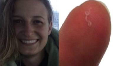 Una mujer de Oregon se aterrorizó al encontrar varios gusanos en su ojo.