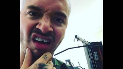 J Balvin muestra su dentadura quebrada.