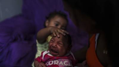 Brasil ha sido el país más afectado por los casos de microcefalia en madres que fueron infectadas por el virus del zika.