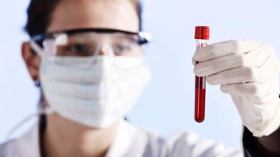 El test de sangre podrá identificar si es candidato a sufrir un accidente cerebrovascular.