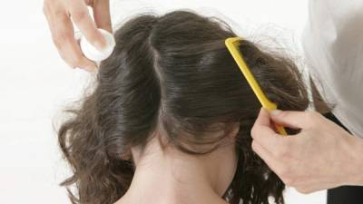 Se pueden quitar los piojos usando un peine de púas finas o un tratamiento del pelo comercial