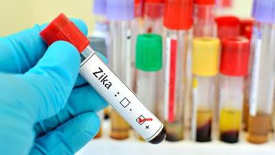 EUA examinará la sangre donada para evitar contagios de zika.