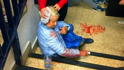 Las fuerzas del orden han golpeado a mujeres y ancianos durante la jornada del referéndum en Cataluña.