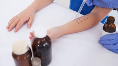 Se realizaron pruebas a los niños para establecer el tipo de alergia padecen.