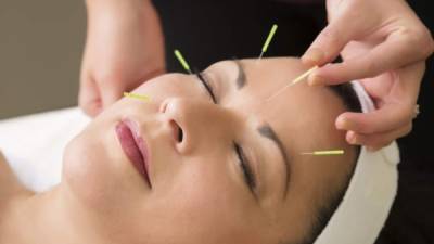 La electroacupuntura es muy usada para tratar problemas de dolor de cabeza y otras enfermedades.