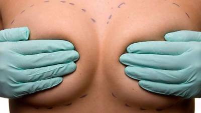 El implante para el aumento del pecho, sigue siendo el procedimiento más popular.