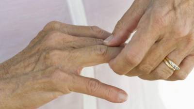 Las personas con artritis rematoidea puede aumentar su afección durante el invierno.