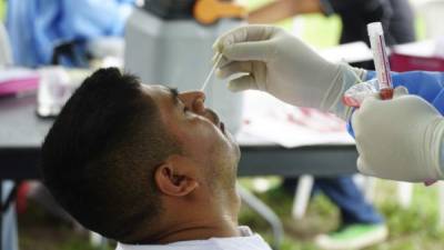 La prueba para detectar el ARN del virus es la PCR, que se obtiene mediante un hisopado nasal. Foto: Amílcar Izaguirre.