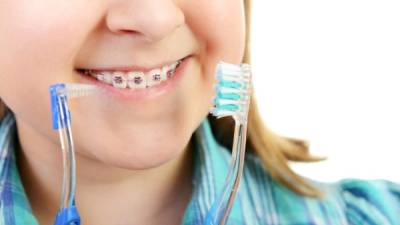 teeth with braces closeup