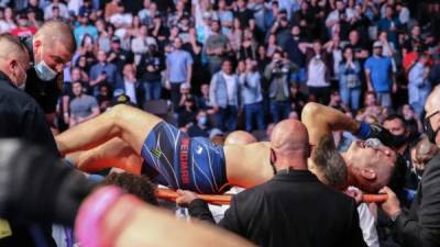 Chris Weidman sufrió una terrible fractura tras aplicar patada a Uriah Hall. Foto AFP.