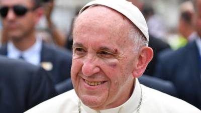 La sangre en el rostro del Papa le alcanzó a manchar la capa de la túnica blanca. Foto EFE.