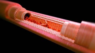 Los vasos sanguíneos artificiales disponibles actualmente están hechos de materiales como los fluoroplásticos.