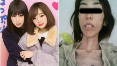 La mujer japonesa esta en sus veintes y ya se encuentra recuperada.