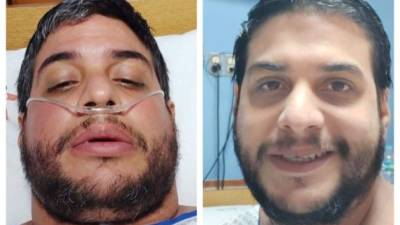 Farid permaneció 9 días en el hospital luego de dar positivo.