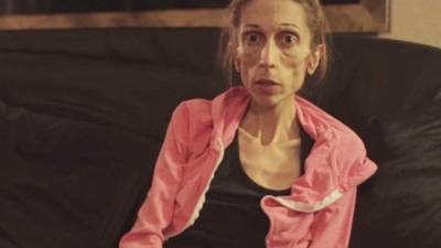 La actriz Rachel Ferrokh impactó al mundo hace unos meses al difundir un video donde rogaba por ayuda para salvar su vida tras sufrir un caso grave de anorexia.