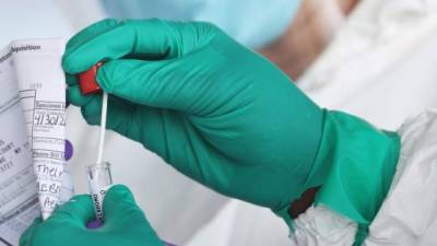 WANTAGH, NEW YORK - APRIL 30: A Health Care Worker seals a coronavirus swab after testing at the Pro Health Urgent Care coronavirus testing site on April 30, 2020 in Wantagh, New York. The World Health Organization declared coronavirus (COVID-19) a global pandemic on March 11th. Al Bello/Getty Images/AFP