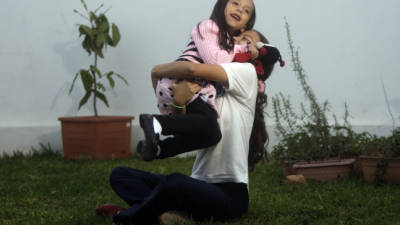 Nimra Nazar es una niña feliz gracias al amor de sus padres y el apoyo de Teletón.