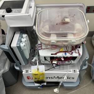 Dispositivos tecnológicos alargan vida de órganos para trasplantes