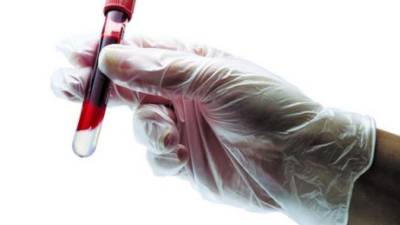 Con una prueba de sangre se puede detectar el virus del ébola.