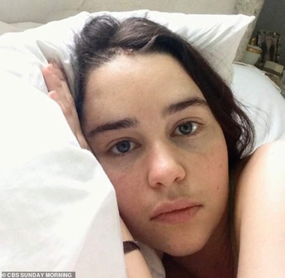 Emilia Clarke comparte fotos inéditas de su hospitalización tras aneurisma cerebral