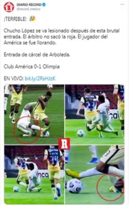 Diario Récord en sus redes sociales - “¡Terrible! Entrada de cárcel de Arboleda. Chucho López se va lesionado después de esta brutal entrada. El árbitro no sacó la roja. El jugador del América se fue llorando“.