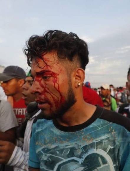 Al menos 12 migrantes resultaron heridos durante los disturbios registrados la tarde del domingo en la frontera entre Guatemala y México.
