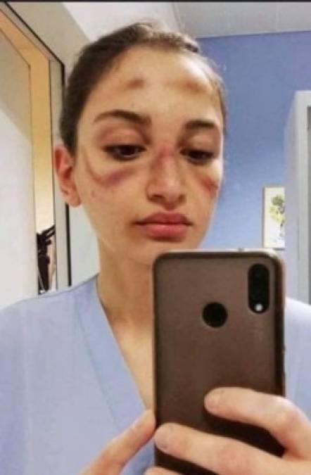 La enfermera italiana Alessia Bonaire también publicó una selfie en sus redes sociales pidiéndole a sus seguidores que por favor se quedaran en casa para evitar nuevos contagios del letal virus.
