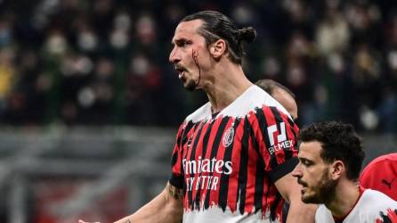 Zlatan Ibrahimovic tuvo un choque con el chileno Gary Medel y así quedó su rostro. Foto AFP.