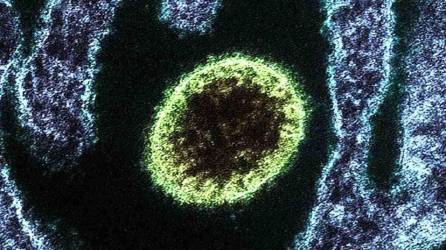 El resurgimiento del virus Nipah ha incendiado las alarmas a nivel mundial luego de que se reportaran miles de casos en India y que ha dejado como saldo dos personas fallecidas.