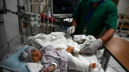 En los hospitales se sigue atendiendo otro tipo de enfermedades, no solo el coronavirus. Los padres de familia se tienen que poner alertas ante todas las enfermedades.(Photo by Wakil KOHSAR / AFP)