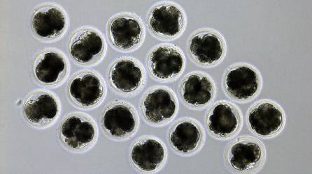 Proceso de clonación de un cerdo modificado genéticamente para reducir el riesgo de rechazo por parte de un receptor humano en un xenotrasplante.