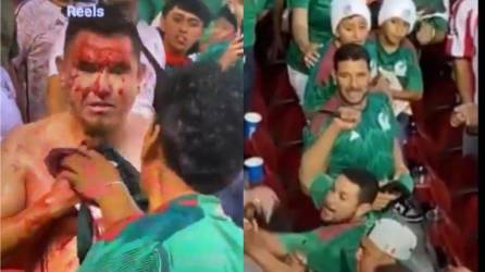 El aficionado fue apuñalado durante el México vs Qatar.