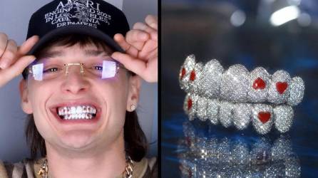 El artista Peso Pluma presume las joyas en sus dientes.