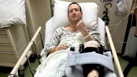 Mark Zuckerberg está en recuperación.