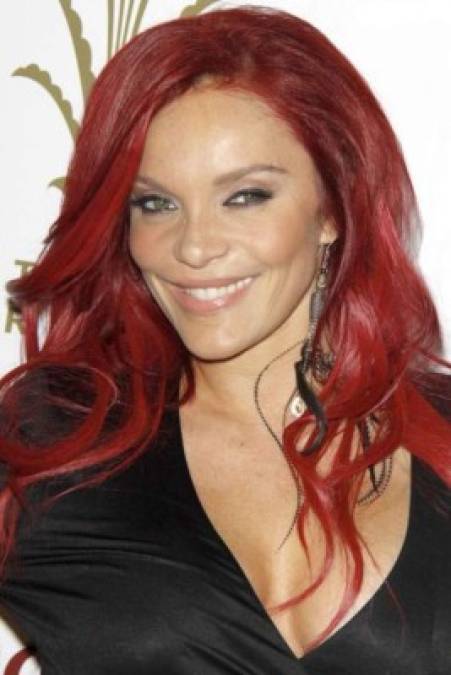 La modelo y cantante Carmit Bachar, conocida por ser una de las cantantes y bailarinas del grupo femenino estadounidense Pussycat Dolls, también nació con labio leporino.