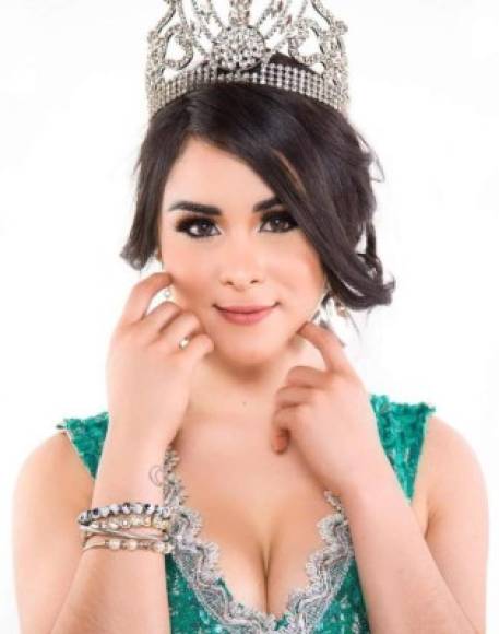 Ónice, conocida en las redes como 'Campanita', ya fue ganadora del Miss Petite Beauty Universe 2017.