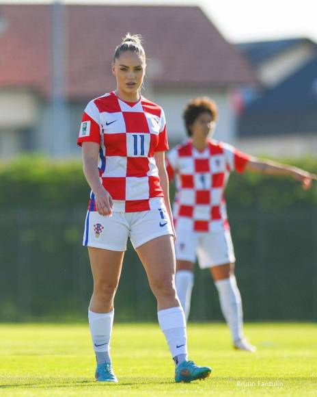 Ana María Marković reveló que hará a un lado del fútbol debido a una terrible lesión que sufrió este fin de semana.