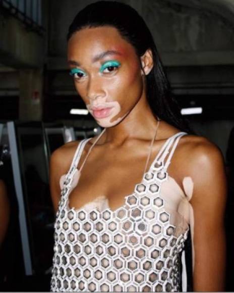 Winnie Harlow<br/>Es una modelo canadiense y portavoz de la condición de piel llamada vitiligo. Tuvo destacada participación como concursante del ciclo 21 del programa de televisión estadounidense America's Next Top Model debido a su condición. Aunque oficialmente fue descubierta por Instagram.