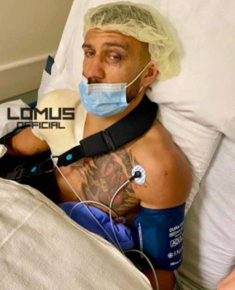 Lomachenko reapareció en sus redes sociales y señaló que la operación a la que se sometió fue un éxito.