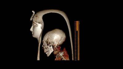 Los científicos sometieron a la momia a una técnica de imagen médica en 3D muy avanzada, la tomografía asistida por computadora.