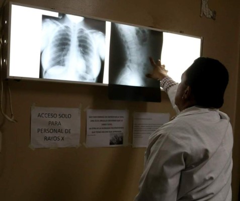 Urgen de técnicos radiólogos en hospitales públicos de Honduras
