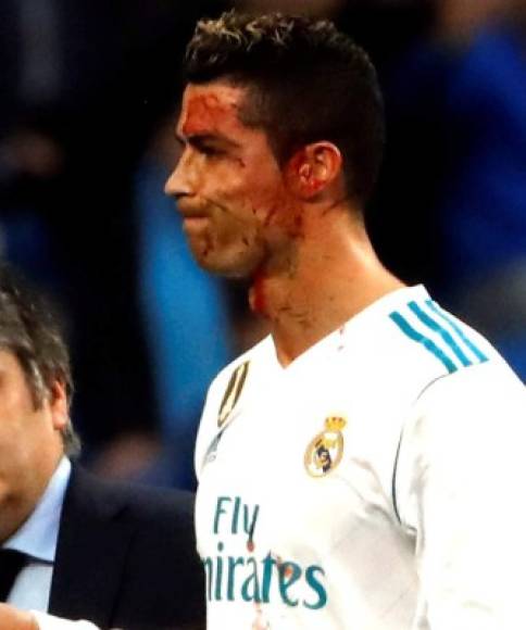 Cristiano Ronaldo recibió un terrible golpe y su rostro se llenó de sangre.