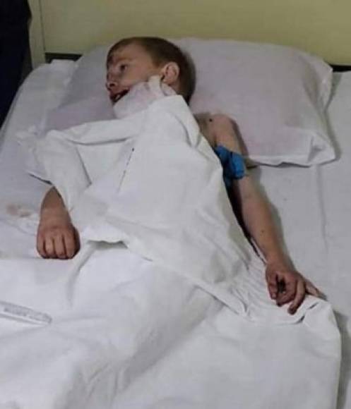 Cody Grayson, 7, uno de los hijos de Dewna, sufrió varias heridas en el ataque y se recupera en un hospital.