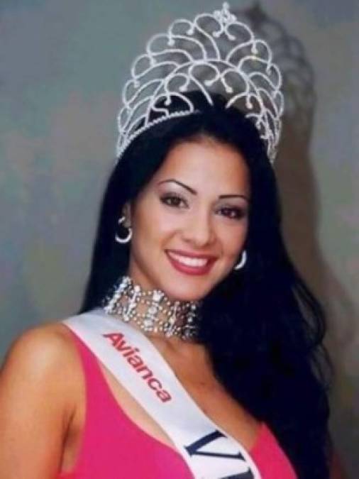 Norkys llegó a ser famosa cuando obtuvo el puesto de primera finalista en el Miss Venezuela 1999. Ese fue el verdadero comienzo de su exitosa carrera.