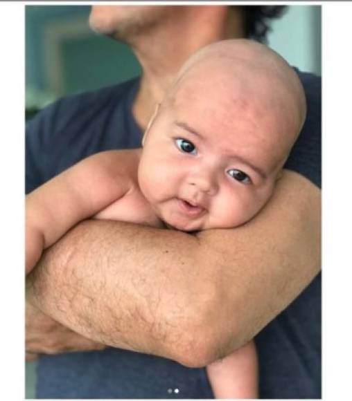 Aunque todo hasta el momento habían sido comentarios positivos acerca de Adal y su nueva familia, unas recientes imágenes del bebé con su cabeza rapada provocó miles de reacciones negativas. <br/><br/>