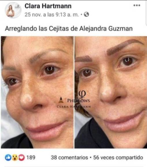 Una foto sin maquillaje que subió la cantante Alejandra Guzmán a sus redes sociales, para mostrar cómo lucía después de tatuarse las cejas, desató una ola de comentarios porque el aspecto del rostro de la cantante era diferente al que lucía hace algunos meses.<br/>